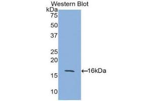 Western blot analysis of the recombinant protein. (ACVR2A anticorps  (AA 20-135))