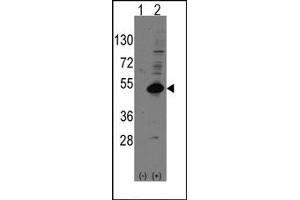 Image no. 1 for anti-Nuclear Receptor Subfamily 0, Group B, Member 1 (NR0B1) (C-Term) antibody (ABIN357834) (NR0B1 anticorps  (C-Term))