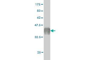 Western Blot detection against Immunogen (37.