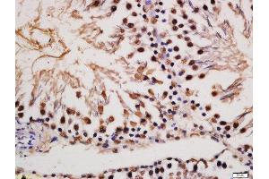 Formalin-fixed and paraffin embedded rat testis labeled with Rabbit Anti-MAP2(Ser136) Polyclonal Antibody, Unconjugated (ABIN743648) at 1:200 followed by conjugation to the secondary antibody and DAB staining (MAP2 anticorps  (pSer136))