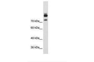 Image no. 1 for anti-Myotubularin Related Protein 1 (MTMR1) (AA 551-600) antibody (ABIN203423) (MTMR1 anticorps  (AA 551-600))