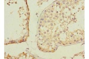 Immunohistochemistry of paraffin-embedded human testis tissue using ABIN7176401 at dilution of 1:100