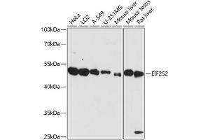 Western blot analysis of extracts of various cell lines, using EIF2S2 antibody (ABIN7267033) at 1:3000 dilution. (EIF2S2 anticorps  (AA 1-175))