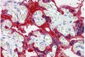 Human Placenta: Formalin-Fixed, Paraffin-Embedded (FFPE)