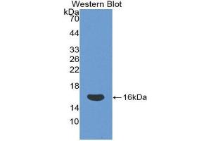 Western Blotting (WB) image for anti-CD160 (CD160) (AA 37-154) antibody (ABIN1858289) (CD160 anticorps  (AA 37-154))