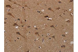 The image on the left is immunohistochemistry of paraffin-embedded Human brain tissue using ABIN7191822(PDE5A Antibody) at dilution 1/50, on the right is treated with synthetic peptide. (PDE5A anticorps)