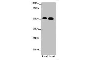 Western blot All lanes: ATMIN antibody at 1. (ATM Interactor anticorps  (AA 160-360))