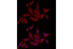 Immunofluorescence analysis of U2OS cells using F Rabbit pAb (ABIN6127814, ABIN6140422, ABIN6140423 and ABIN6221993) at dilution of 1:200 (40x lens).
