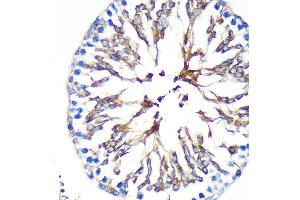 Immunohistochemistry of paraffin-embedded Rat testis using KIF17 Rabbit pAb (ABIN7268123) at dilution of 1:100 (40x lens). (KIF17 anticorps  (AA 360-660))