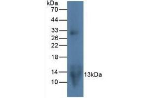 Detection of MIP3a in Rat Lymphocyte Cells using Monoclonal Antibody to Macrophage Inflammatory Protein 3 Alpha (MIP3a) (CCL20 anticorps  (AA 24-95))