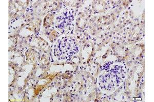 Antigen: 0. (IL17 Receptor B anticorps  (AA 351-450))