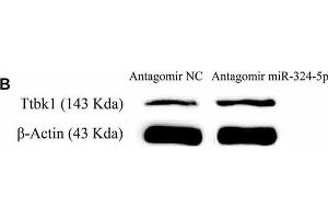 miRNA-324-5p acts onto Ttbk1 and downregulates Tau-tubulin kinase-1. (beta Actin anticorps)