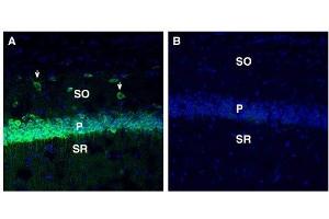 Expression of SORL1 in mouse hippocampus. (SORL1 anticorps  (Extracellular, N-Term))