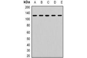 Western blot analysis of CD133 expression in K562 (A), SW620 (B), Jurkat (C), mouse kidney (D), mouse lung (E) whole cell lysates.