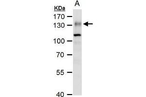 WB Image ENPP1 antibody [N2C2], Internal detects ENPP1 protein by western blot analysis. (ENPP1 anticorps)