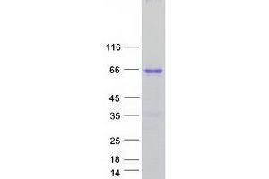 Validation with Western Blot