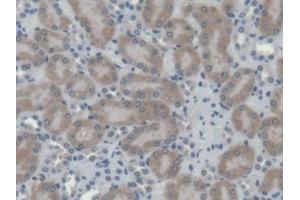 DAB staining on IHC-P; Samples: Mouse Kidney Tissue
