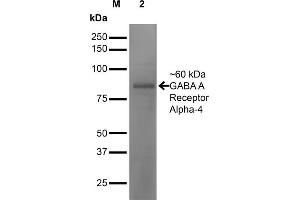 Western Blot analysis of Mouse Brain showing detection of ~60 kDa GABA-A-Receptor-Alpha4 protein using Mouse Anti-GABA-A-Receptor-Alpha4 Monoclonal Antibody, Clone S398A-34 . (GABRA1 anticorps  (AA 410-450) (PerCP))
