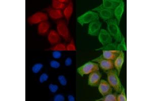 ABIN6258681 and ABIN6274241 staining Hela cells(45 min of heat-shock) by IF/ICC. (ACTN2/3 anticorps  (N-Term))