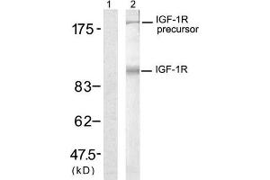 Western blot analysis of extract from 293 cells, using IGF-1R (Ab-1280) antibody (E021302, Lane 1 and 2). (IGF1R anticorps)