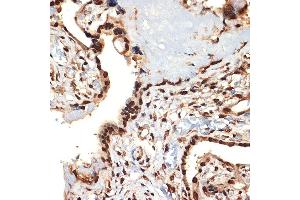 Immunohistochemistry of paraffin-embedded human placenta using CIRBP Rabbit mAb (ABIN7266452) at dilution of 1:100 (40x lens).