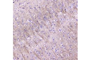 IHC analysis of MAP1LC3A using anti-MAP1LC3A antibody .