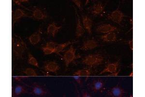 Immunofluorescence analysis of C6 cells using SLC25A24 Polyclonal Antibody at dilution of 1:100.