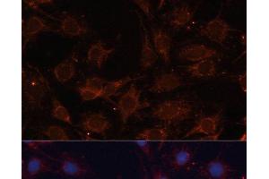 Immunofluorescence analysis of C6 cells using SLC25A24 Polyclonal Antibody at dilution of 1:100.