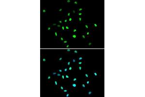 Immunofluorescence analysis of A549 cells using HDAC1 antibody. (HDAC1 anticorps  (AA 393-482))