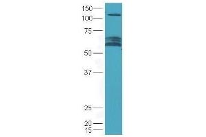 Lane 1: mouse brain lysates probed with Rabbit Anti-Chrm3 Polyclonal Antibody, Unconjugated  at 1:5000 for 90 min at 37˚C. (CHRM3 anticorps  (AA 481-589))