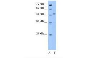 Image no. 1 for anti-Zona Pellucida Glycoprotein 4 (ZP4) (N-Term) antibody (ABIN6738590) (ZP4 anticorps  (N-Term))