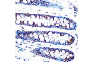 Immunohistochemistry of paraffin-embedded human colon using Lumican (LUM) (LUM) Rabbit mAb (ABIN7268309) at dilution of 1:100 (40x lens).