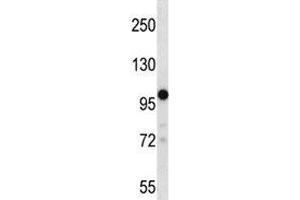 TRPM4 antibody western blot analysis in 293 lysate.