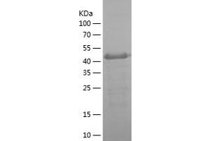 Western Blotting (WB) image for Carbonic Anhydrase IX (CA9) (AA 38-153) protein (His-IF2DI Tag) (ABIN7122130)