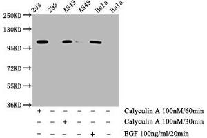 Western Blot  Positive WB detected in: 293 whole cell lysate, A549 whole cell lysate, Hela whole cell lysate (treated with Calyculin A or EGF)  All lanes: Phospho-ERN1 antibody at 0. (Recombinant ERN1 anticorps  (pSer724))