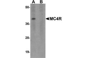 Western Blotting (WB) image for anti-Melanocortin 4 Receptor (MC4R) (N-Term) antibody (ABIN1031454) (MC4R anticorps  (N-Term))