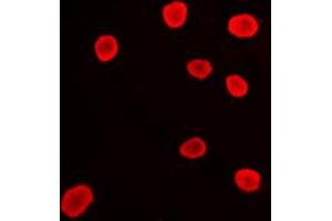 Immunofluorescent analysis of Histone Deacetylase 9 staining in Ramos cells. (HDAC9 anticorps  (C-Term))
