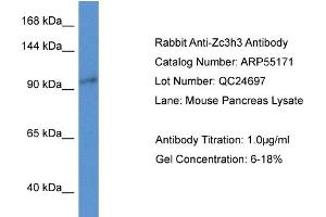 Western Blotting (WB) image for anti-Zinc Finger CCCH-Type Containing 3 (ZC3H3) (N-Term) antibody (ABIN2786081) (ZC3H3 anticorps  (N-Term))
