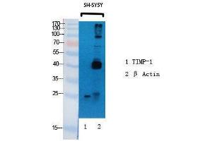 Western Blotting (WB) image for anti-TIMP Metallopeptidase Inhibitor 1 (TIMP1) (Internal Region) antibody (ABIN3187268) (TIMP1 anticorps  (Internal Region))