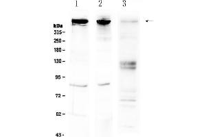 Western blot analysis of Sacsin using anti-Sacsin antibody .