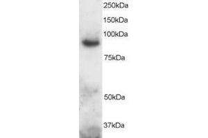 ABIN184726 staining (2µg/ml) of Human Brain lysate (RIPA buffer, 30µg total protein per lane). (ADAM8 anticorps  (C-Term))