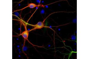 Immunofluorescence labeling of PFA fixed rat hippocampus neurons with β3-tubulin (dilution 1 : 500; red) and mouse anti-MAP 2 (cat.