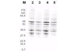 This product was assayed by western blotting against RFA2 containing cell lysates. (RPA2 anticorps  (AA 115-129))
