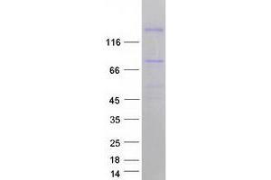 Validation with Western Blot