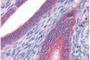 Human Uterus (formalin-fixed, paraffin-embedded) stained with DRAM antibody ABIN351448 at 3 ug/ml followed by biotinylated goat anti-rabbit IgG secondary antibody ABIN481713, alkaline phosphatase-streptavidin and chromogen. (DRAM anticorps  (C-Term))