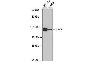 Western blot analysis of extracts of various cell lines using IL1R1 Polyclonal Antibody at dilution of 1:1000. (IL1R1 anticorps)