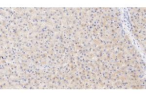 Detection of ITIH4 in Human Liver Tissue using Polyclonal Antibody to Inter Alpha-Globulin Inhibitor H4 (ITIH4)