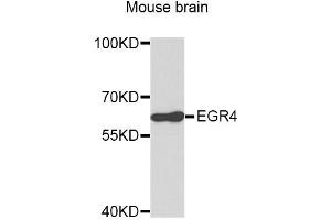 Western blot analysis of extracts of mouse brain, using EGR4 antibody (ABIN3049538). (EGR4 anticorps)