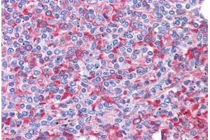 Human Spleen: Formalin-Fixed, Paraffin-Embedded (FFPE)