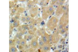 Used in DAB staining on fromalin fixed paraffin-embedded Liver tissue (Factor XI anticorps  (AA 170-398))